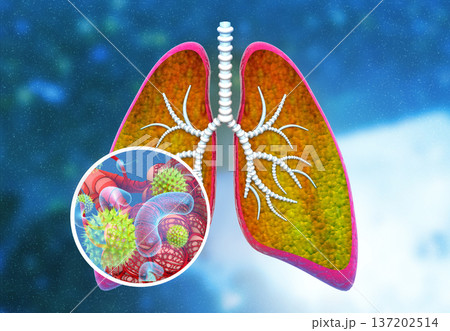 Virus, bacteria in human lungs Virus, bacteria in human lungs 137202514
