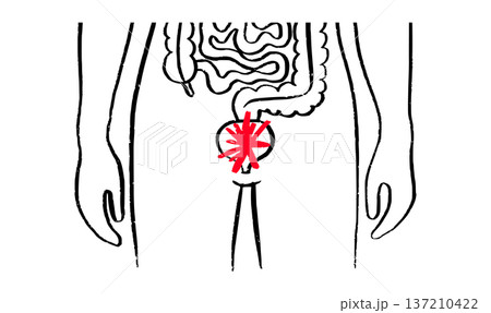 Bladder inflammation pain 137210422