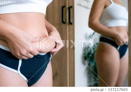 Woman body. Cellulite and fat folds close up. Health awareness c Woman body. Cellulite and fat folds close up. Health awareness c 137217603