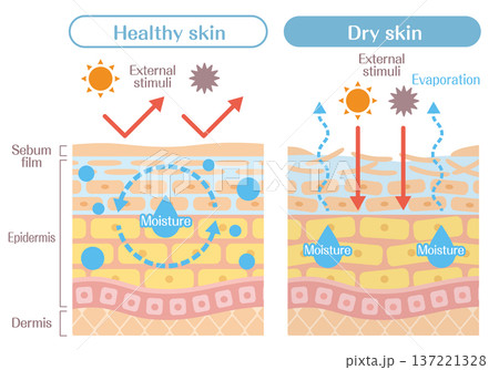 乾燥肌と健康な肌の違いを解説する皮膚構造イラスト(水分蒸発・外部刺激) 乾燥肌と健康な肌の違いを解説する皮膚構造イラスト(水分蒸発・外部刺激) 137221328