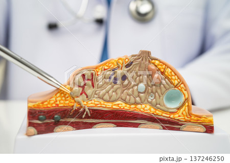 doctor holding female breast human anatomy model. doctor holding female breast human anatomy model. 137246250