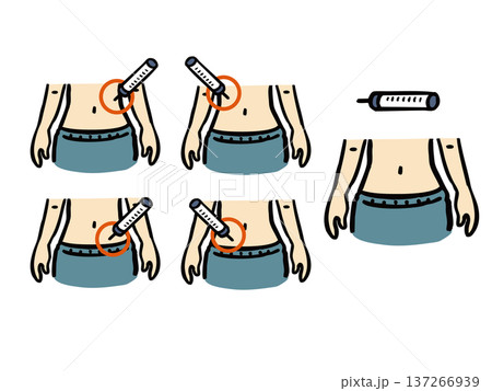 お腹への注射　注射位置　イラストセット 137266939