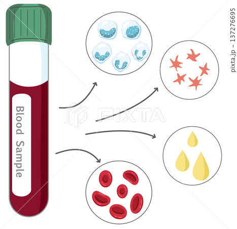 Blood Sample Analysis - Blood Tube with Red and White Blood Cells, Platelets, and Plasma Blood Sample Analysis - Blood Tube with Red and White Blood Cells, Platelets, and Plasma 137276695