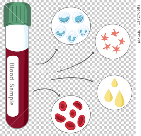 Blood Sample Analysis - Blood Tube with Red and White Blood Cells, Platelets, and Plasma Blood Sample Analysis - Blood Tube with Red and White Blood Cells, Platelets, and Plasma 137276695
