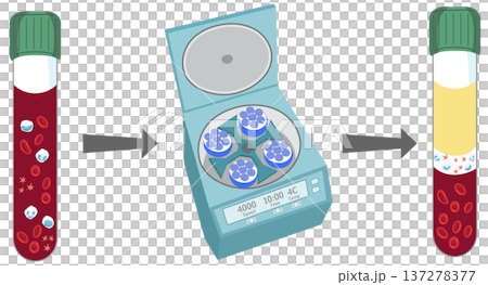 Blood Plasma Separation Process- Centrifugation of Blood Sample in Heparin Tube 137278377