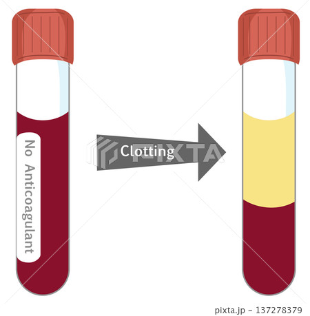 Blood Serum Separation Process - Blood Clotting in Test Tube without Anticoagulant 137278379