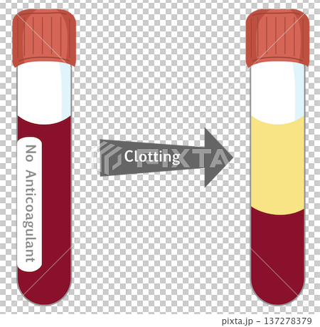 Blood Serum Separation Process - Blood Clotting in Test Tube without Anticoagulant 137278379