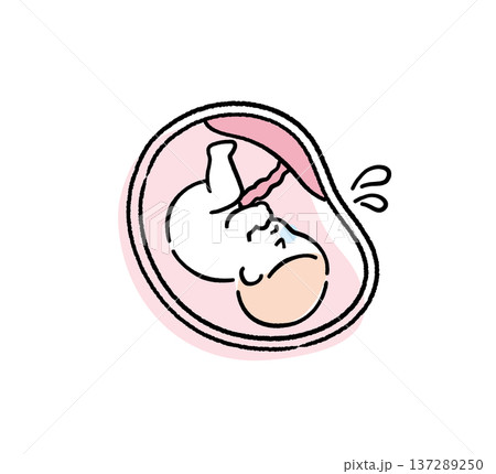 苦しそうな赤ちゃん｜出産・医療説明用イラスト 137289250