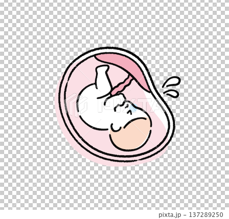 苦しそうな赤ちゃん｜出産・医療説明用イラスト 137289250
