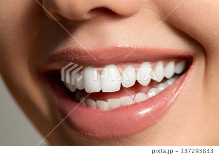 Skincare routine includes smiling woman showing her healthy teeth and skin at a bright spa location with natural light 137293833
