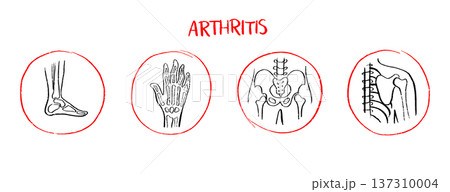 Arthritis Sketch Poster Arthritis Sketch Poster 137310004