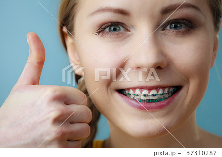 Young woman showing teeth braces 137310287