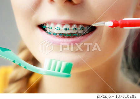 Girl with teeth braces using interdental and traditional brush 137310288