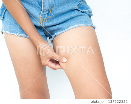 Fat thigh Cellulite Woman for Liposuction, Slim Leg Perfect Model shapely Girl, Female Diet Yoga Control Weige, Health Loss from Massage. Fat thigh Cellulite Woman for Liposuction, Slim Leg Perfect Model shapely Girl, Female Diet Yoga Control Weige, Health Loss from Massage. 137322322