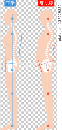 背部呈弓形且姿勢正確的女性：脊椎和骨盆 137329820