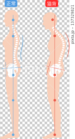 女性的駝背和正確姿勢：脊椎和骨盆 137329821