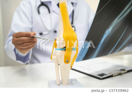 Doctor examining knee joint bone radiography xray film. 137339962