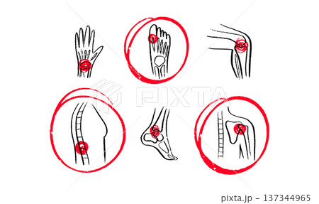 Arthritis Sketch Poster 137344965