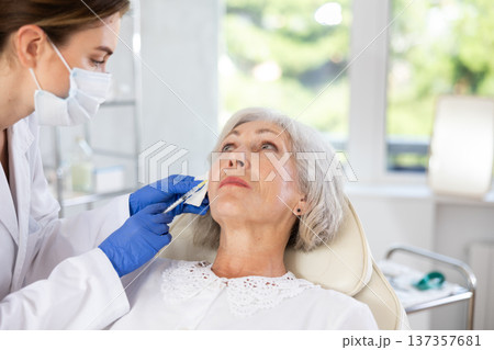 Elderly patient getting lip fillers. 137357681