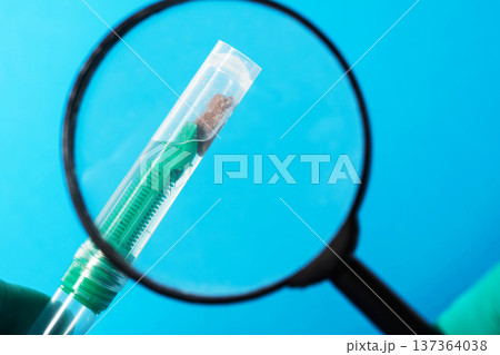 A test tube containing biomaterial and stool analysis under a magnifying glass. Concept of a stool test for fecal calprotectin, close-up 137364038