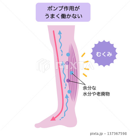 脚のむくみ 浮腫のしくみ 脚のむくみ 浮腫のしくみ 137367598