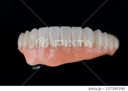 Full dental zirconium prosthesis on titanium bar stained with stains for ceramic. Lower jaw Full dental zirconium prosthesis on titanium bar stained with stains for ceramic. Lower jaw 137390390