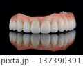 Full dental zirconium prosthesis on titanium bar stained with stains for ceramic. Upper jaw 137390391