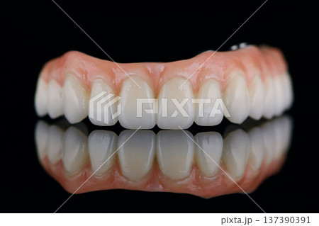 Full dental zirconium prosthesis on titanium bar stained with stains for ceramic. Upper jaw 137390391
