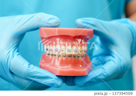 Asian dentist holding dental teeth model for learn about dentistry. 137394509
