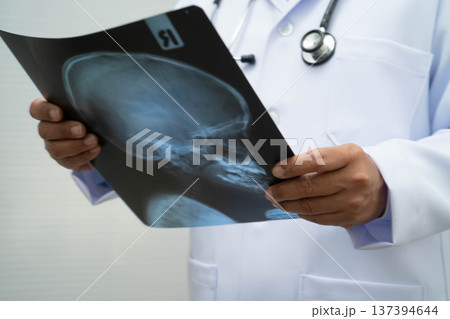Doctor examining brain radiography xray film. Doctor examining brain radiography xray film. 137394644