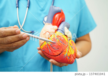 Cardiovascular disease CVD, doctor with heart human model anatomy for treatment patient in hospital. Cardiovascular disease CVD, doctor with heart human model anatomy for treatment patient in hospital. 137401041