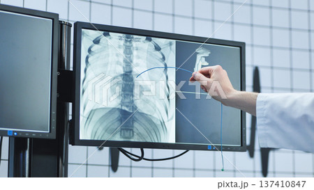 Doctor performing medical procedure using x-ray image on monitor 137410847