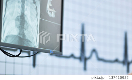 Medical monitor showing a chest x-ray and ecg heart rate results in a hospital 137410925