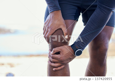 Knee injury, joint pain and fitness person massage legs, broken bone and anatomy problem from workout, exercise or training. Medical emergency risk, closeup and cardio runner with arthritis crisis Knee injury, joint pain and fitness person massage legs, broken bone and anatomy problem from workout, exercise or training. Medical emergency risk, closeup and cardio runner with arthritis crisis 137420955