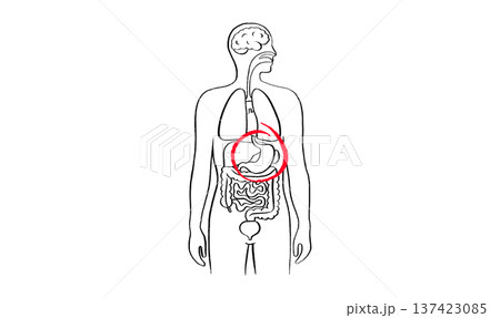 Gastroesophageal reflux pain Gastroesophageal reflux pain 137423085