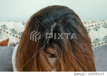 Top view of Asian women's head with new black hair growth. Top view of Asian women's head with new black hair growth. 137431117