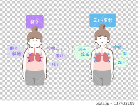 A comparison illustration set of a woman with hunched back and contracted lungs and a woman with correct posture and expanded lungs 137432109