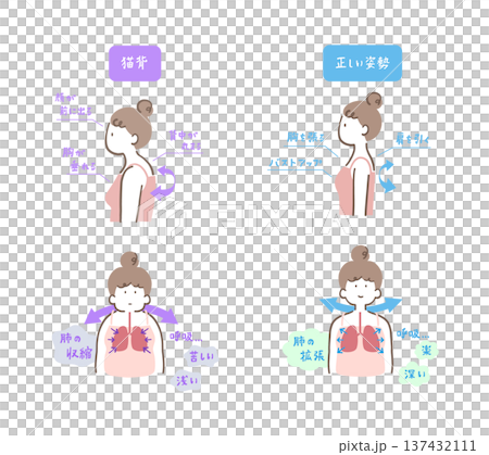 A comparison illustration set of a woman with hunched back and contracted lungs and a woman with correct posture and expanded lungs 137432111