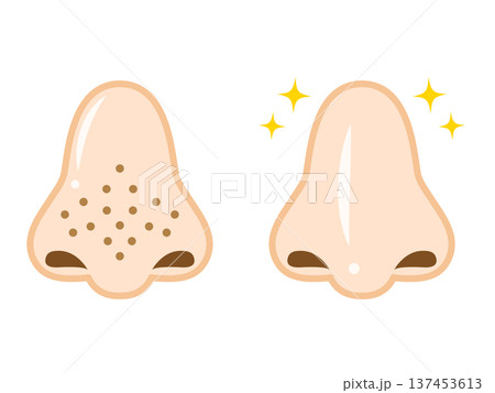 鼻パックでケアする鼻のイラスト素材2 137453613