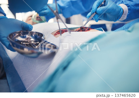 Surgery, team hands and patient operation, hospital emergency or group of doctors help, support or healing wound. Accident injury blood, medical tools and healthcare surgeon teamwork on saving person 137465620