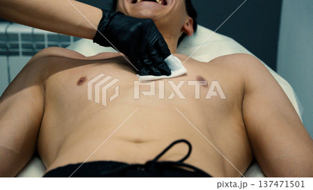 Close up of a man receiving cosmetic chest treatment 137471501