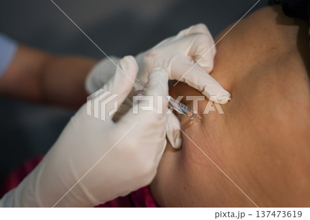 close up doctor is injecting enoxaparin injection to belly with syringe close up doctor is injecting enoxaparin injection to belly with syringe 137473619