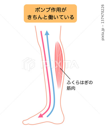 脚のむくみ　浮腫のしくみ 137478226