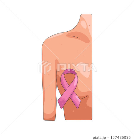 Illustration of Breast cancer Illustration of Breast cancer 137486056
