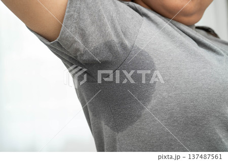 Sweaty underarms, Asian woman with sweat on clothes under armpit. 137487561