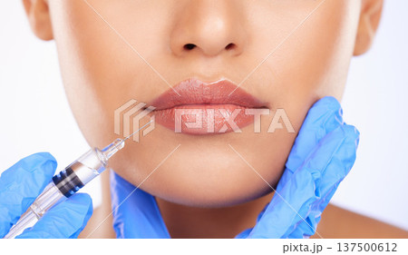 Injection, woman and lips in studio for plastic surgery, beauty process and aesthetic filler on white background. Closeup, mouth and needle from surgeon for facial change, skincare and prp cosmetics 137500612