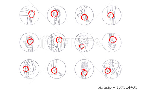 Arthritis Sketch Poster Arthritis Sketch Poster 137514435