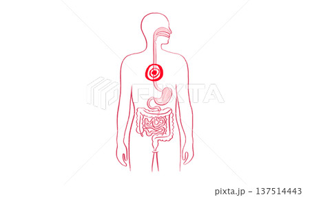 Esophagus pain diagram 137514443
