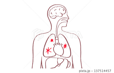 Lung disease concept 137514457