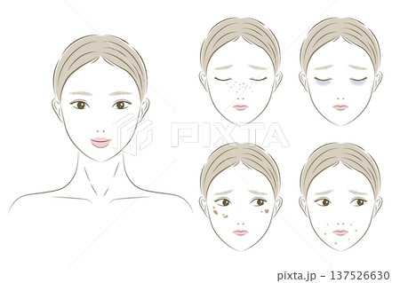 女性の肌トラブルやお悩みイラストセット、シミ、そばかす、ニキビ、クマ、毛穴 女性の肌トラブルやお悩みイラストセット、シミ、そばかす、ニキビ、クマ、毛穴 137526630